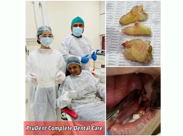 Prudent Complete Dental Care