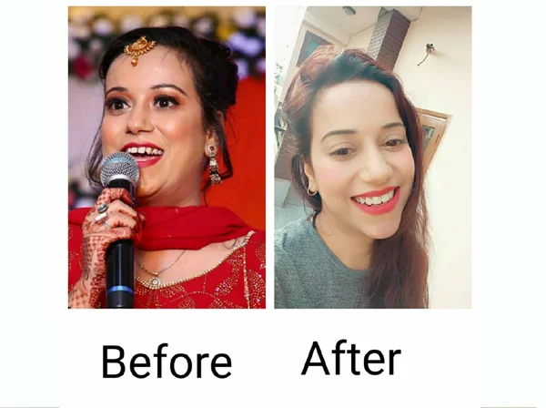 Prudent Complete Dental Care