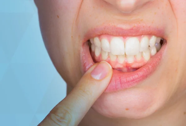 Periodontal Surgery